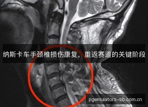 纳斯卡车手颈椎损伤康复,重返赛道的关键阶段 纳斯卡车手颈椎损伤康复,重返赛道的关键阶段